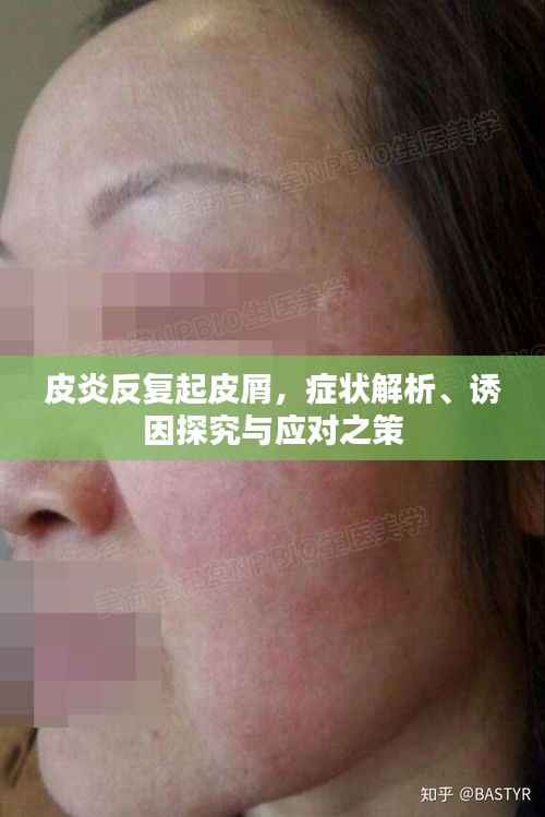 皮炎反复起皮屑,症状解析、诱因探究与应对之策