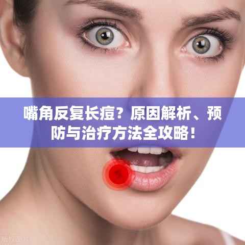 嘴角反复长痘?原因解析、预防与治疗方法全攻略!