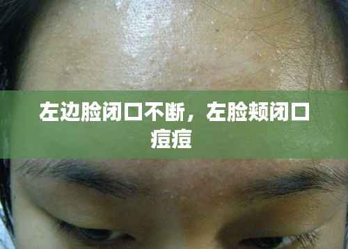 左边脸闭口不断,左脸颊闭口痘痘