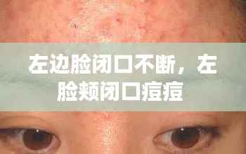 左边脸闭口不断,左脸颊闭口痘痘