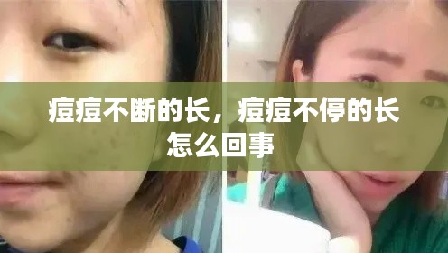 痘痘不断的长,痘痘不停的长怎么回事