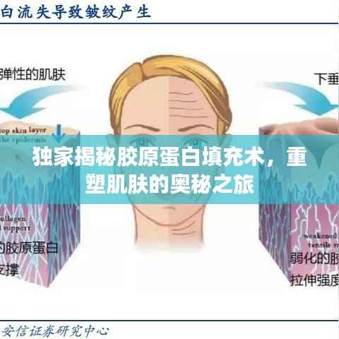 独家揭秘胶原蛋白填充术，重塑肌肤的奥秘之旅