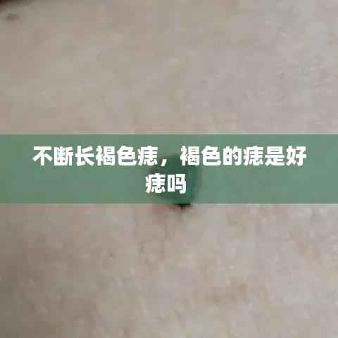不断长褐色痣,褐色的痣是好痣吗