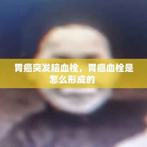 胃癌突发脑血栓,胃癌血栓是怎么形成的