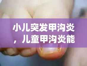 小儿突发甲沟炎,儿童甲沟炎能自愈吗