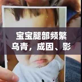 宝宝腿部频繁乌青,成因、影响及应对之策