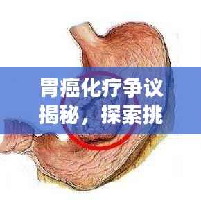胃癌化疗争议揭秘，探索挑战与未来前景展望