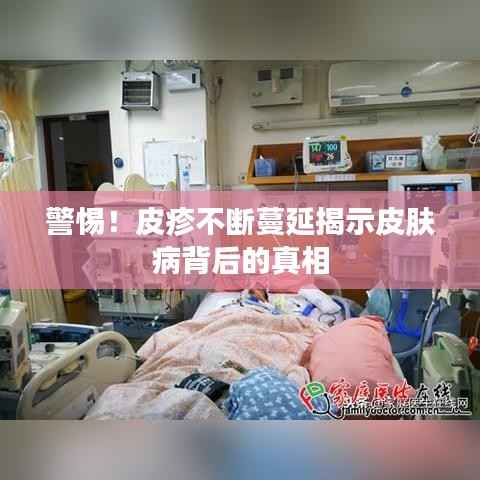 警惕!皮疹不断蔓延揭示皮肤病背后的真相